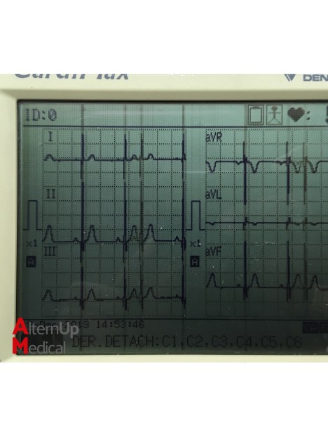Electrocardiogramme Fukuda Denshi CardiMax FX-7102
