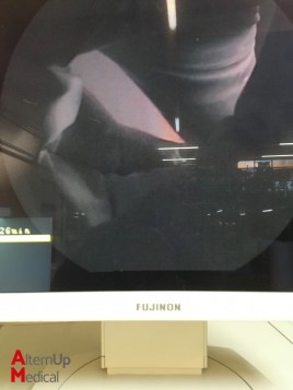 Colonoscope Fujinon EC-250