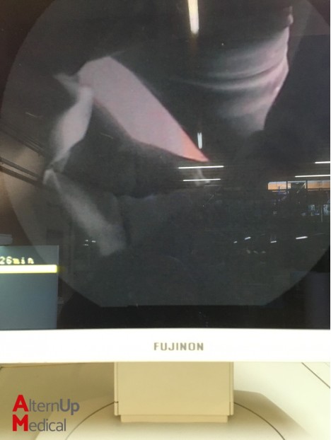 Fujinon EC-250 Colonoscope