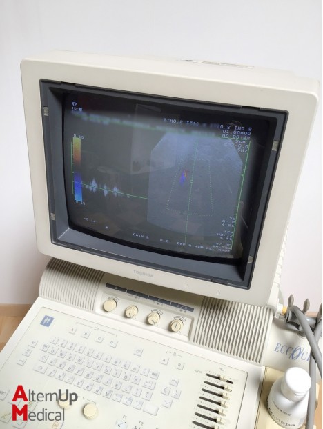 Toshiba SSA-340A Eccocee Ultrasound