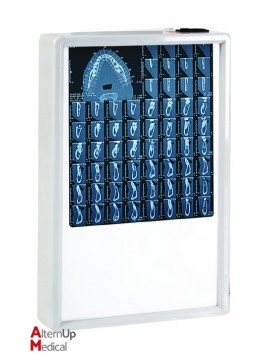 X-Ray Viewbox 38x62 cm