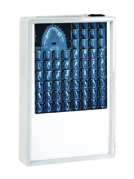 Négatoscope 38x62 cm