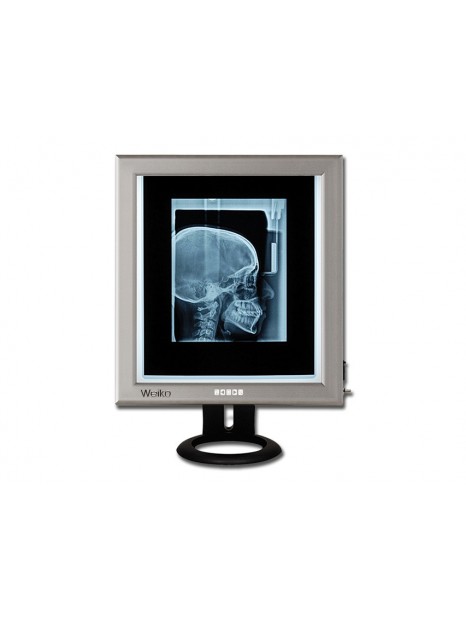 LED X-Ray Viewbox 42x36 cm