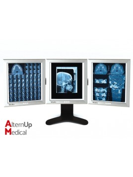 LED Triple X-Ray Viewbox 42x36cm