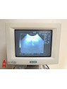 Echographe Siemens Sonoline Adara