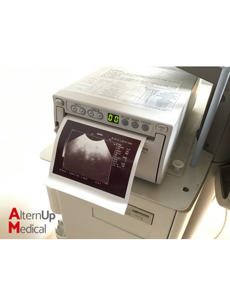 Echographe Siemens Sonoline Adara