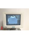 Siemens Sonoline Adara Ultrasound
