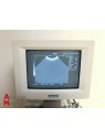 Echographe Siemens Sonoline Adara