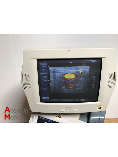 Toshiba SSA-770A Aplio 80 Ultrasound