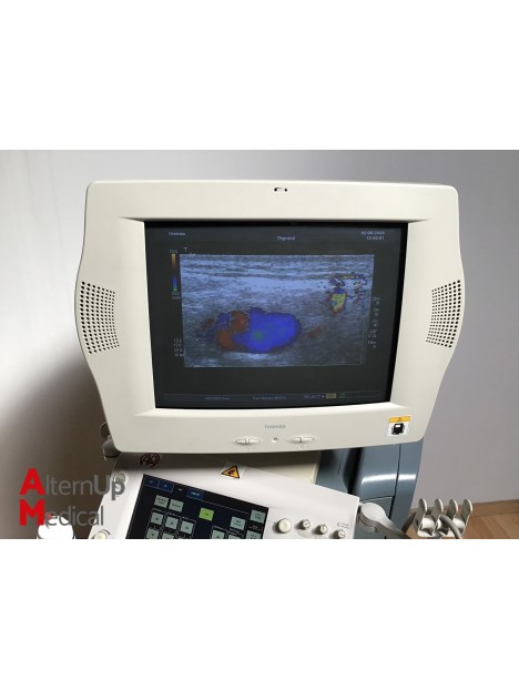 Toshiba SSA-770A Aplio 80 Ultrasound