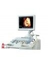 Chision IVIS 30 Color Doppler Ultrasound