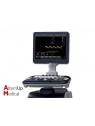 Chison i8 Color Doppler Ultrasound