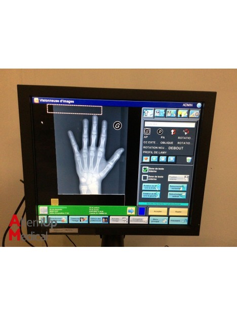Système de radiographie Carestream DirectView Elite CR