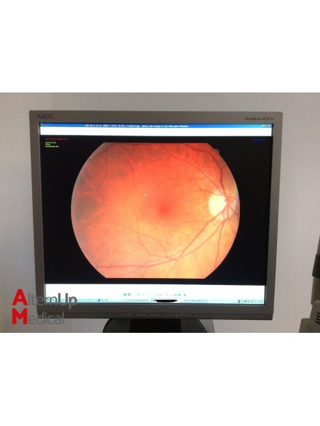 Canon CR-DGI Fundus Camera