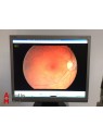Canon CR-DGI Fundus Camera