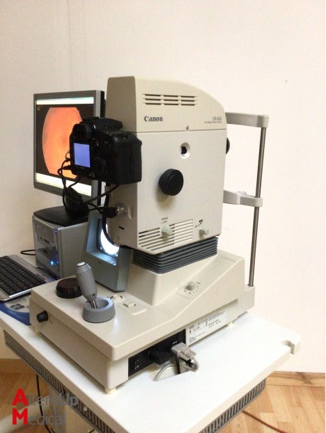 Canon CR-DGI Fundus Camera
