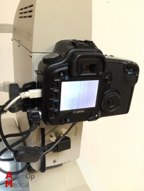 Canon CR-DGI Fundus Camera