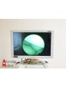 Endoscope Rigide Schölly