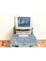 Siemens Acuson Sequoia 512 Ultrasound 