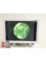 Colonne d'Endoscopie Storz Tricam SL 2