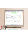 ATYS Looki Transcranial Doppler