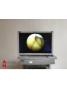 Storz Tricam SL II 202230 20 Endoscopy System