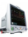 Moniteur Multiparamètres GE Dash 5000