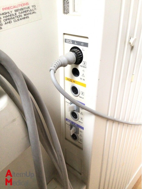 Toshiba Powervision 6000 Ultrasound