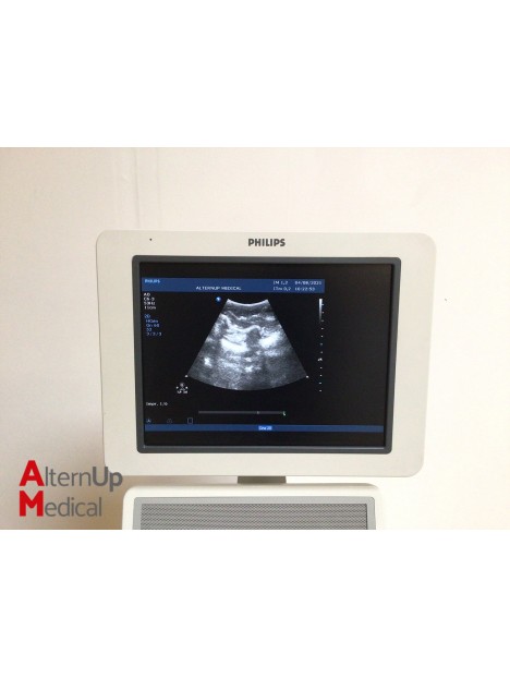 Philips HD15 Ultrasound