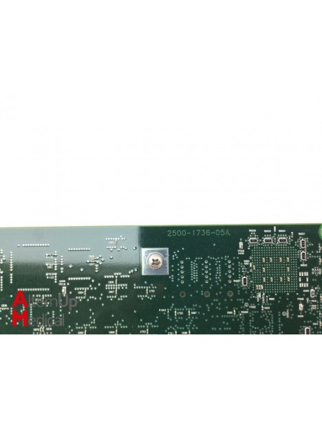 Signal Processing Module for Philips Sono CT HDI 5000