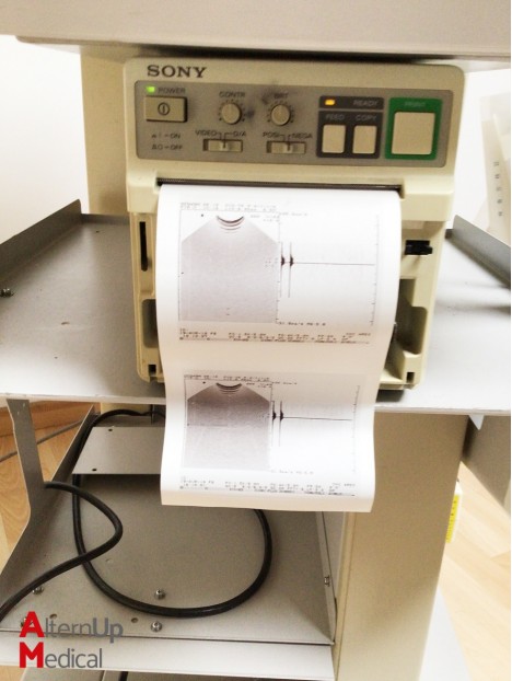Hitachi EUB-525 Odyssée Ultrasound