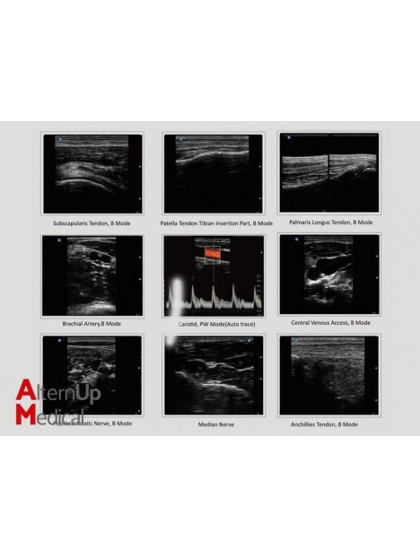 Sonotouch 30 Color Touchscreen Ultrasound