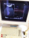 Hitachi EUB-525 Odyssée Ultrasound