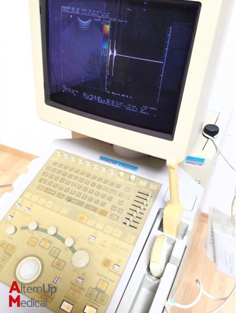 Hitachi EUB-525 Odyssée Ultrasound