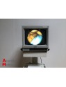 Biodigital CA2 Endoscopy System