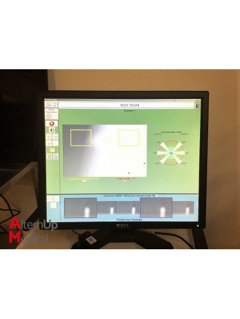 Synapsys Videonystagmography System