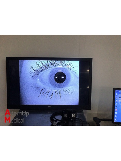 Synapsys Videonystagmography System