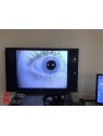 Synapsys Videonystagmography System